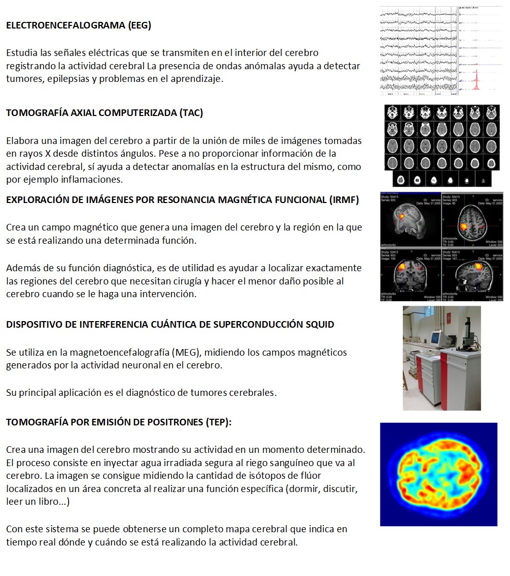 MÉTODOS DE EXPLORACIÓN CEREBRAL 